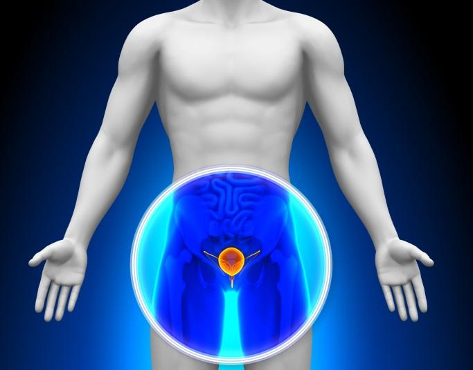 El Tratamiento del Prostatitis Crónica: Avances y Estrategias Efectivas